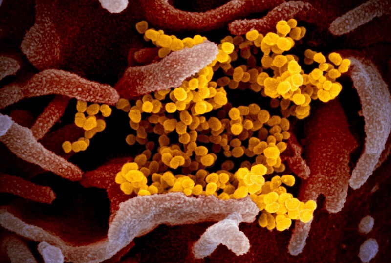 коронавирус под микроскопом от сша